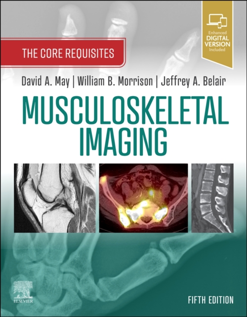 Musculoskeletal Imaging : The Core Requisites, Paperback / softback Book