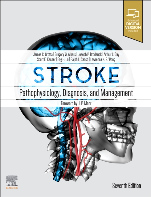 Stroke : Pathophysiology, Diagnosis, and Management, Hardback Book