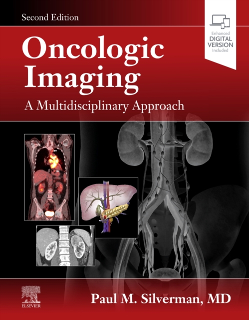 Oncologic Imaging: A Multidisciplinary Approach, Hardback Book