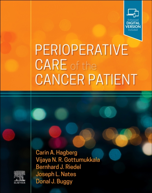 Perioperative Care of the Cancer Patient, Hardback Book