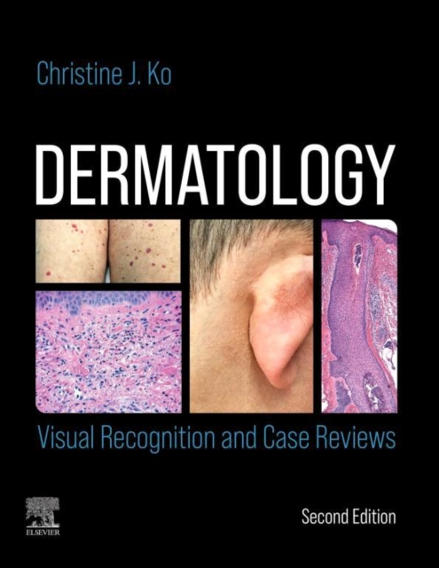 Dermatology: Visual Recognition and Case Reviews E-Book, EPUB eBook