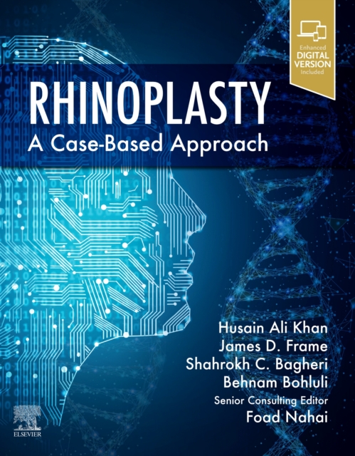 Rhinoplasty : a Case-based approach, Hardback Book