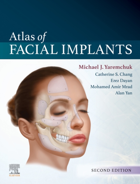 Atlas of Facial Implants E-Book, EPUB eBook