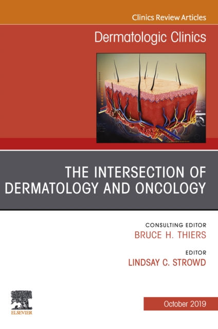 The Intersection of Dermatology and Oncology, An Issue of Dermatologic Clinics, EPUB eBook