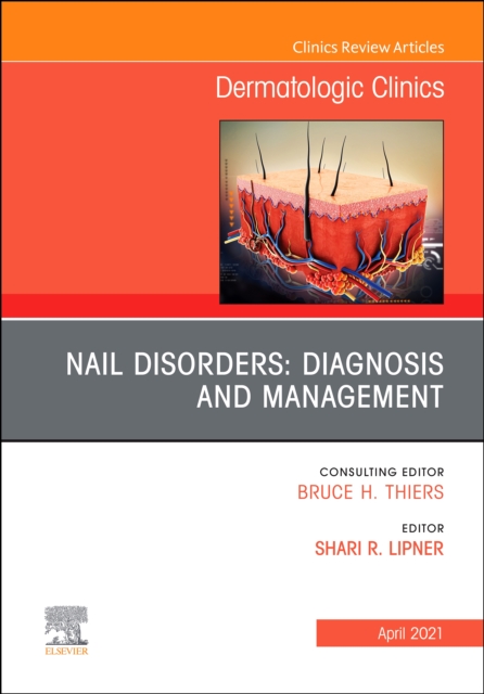 Nail Disorders: Diagnosis and Management, An Issue of Dermatologic Clinics, PDF eBook