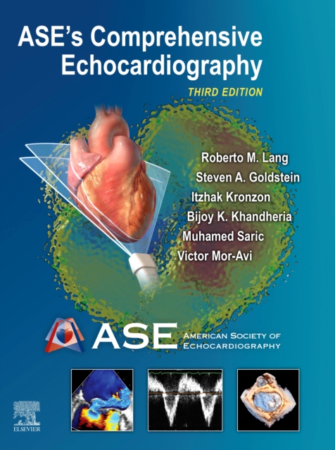 ASE's Comprehensive Echocardiography E-Book : ASE's Comprehensive Echocardiography E-Book, PDF eBook