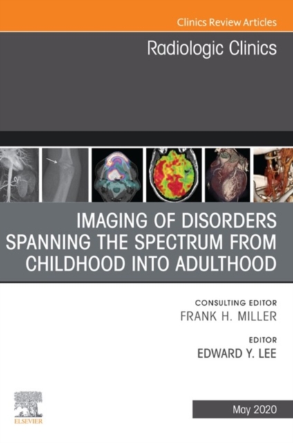 Imaging of Disorders Spanning the Spectrum from Childhood ,An Issue of Radiologic Clinics of North America E-Book : Imaging of Disorders Spanning the Spectrum from Childhood ,An Issue of Radiologic Cl, EPUB eBook