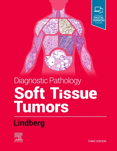 Diagnostic Pathology: Soft Tissue Tumors E-Book : Diagnostic Pathology: Soft Tissue Tumors E-Book, EPUB eBook
