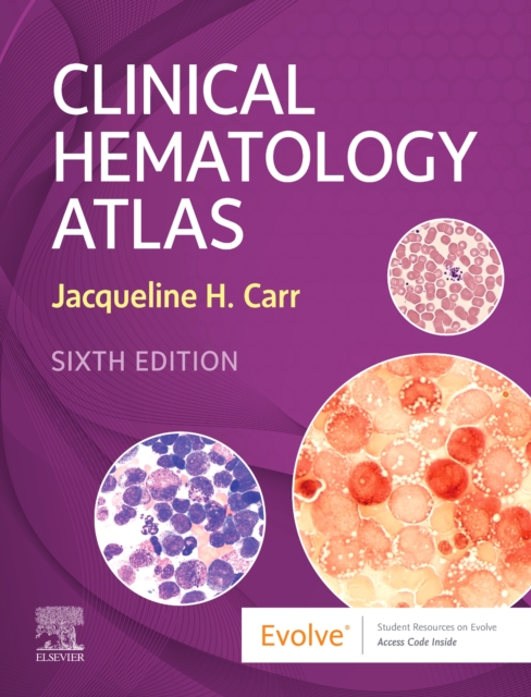 Clinical Hematology Atlas, Spiral bound Book