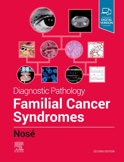 Diagnostic Pathology: Familial Cancer Syndromes E-Book : Diagnostic Pathology: Familial Cancer Syndromes E-Book, EPUB eBook