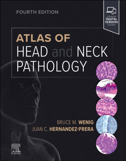 Atlas of Head and Neck Pathology, EPUB eBook