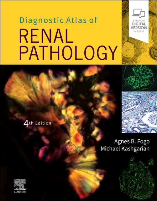 Diagnostic Atlas of Renal Pathology, Hardback Book