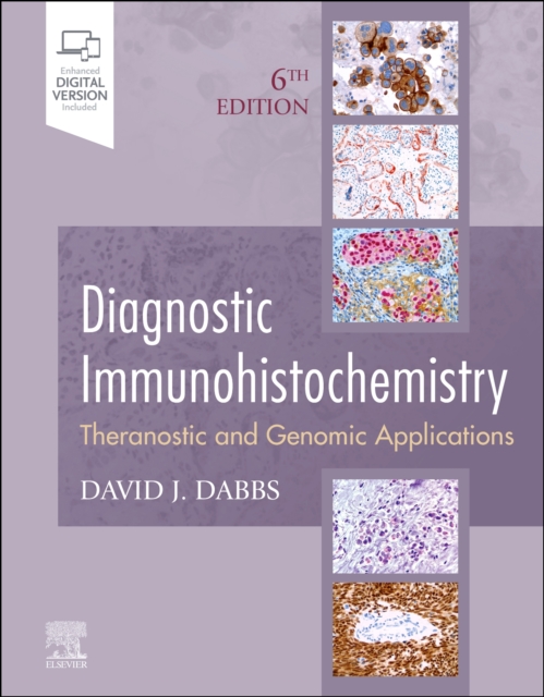 Diagnostic Immunohistochemistry : Theranostic and Genomic Applications, Hardback Book