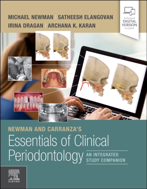 Newman and Carranza's Essentials of Clinical Periodontology : An Integrated Study Companion, Paperback / softback Book