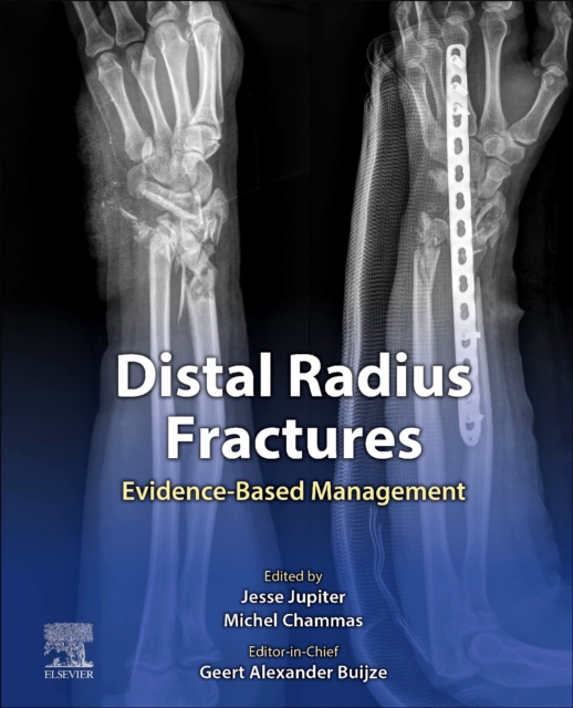 Distal Radius Fractures : Evidence-Based Management, Hardback Book