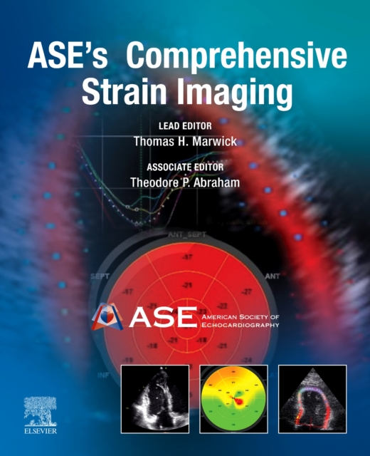 ASE's Comprehensive Strain Imaging, Hardback Book