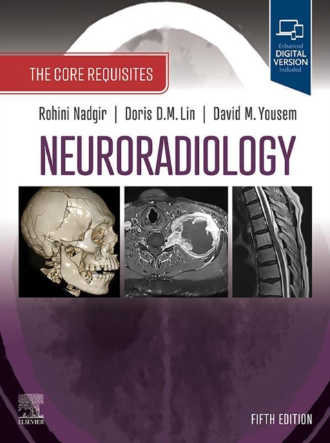 Neuroradiology: The Requisites : The Core Requisites, EPUB eBook