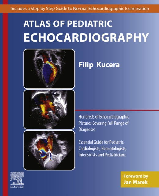 Atlas of Pediatric Echocardiography, EPUB eBook