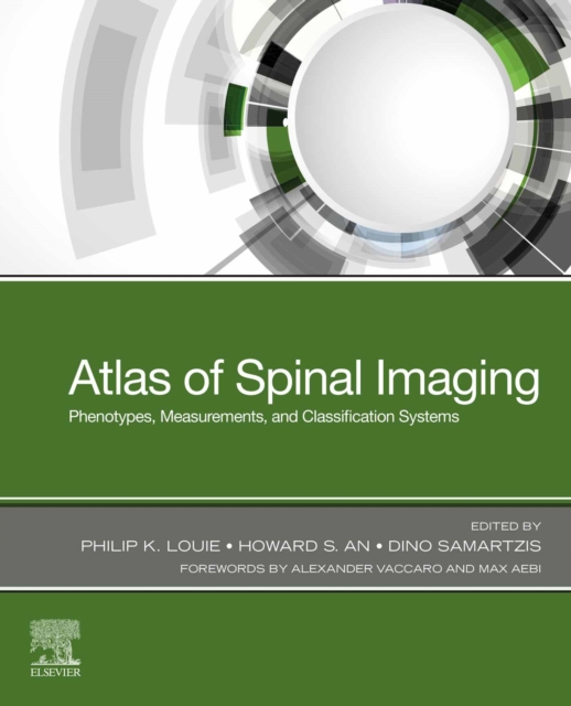 Atlas of Spinal Imaging Phenotypes : Phenotypes, Measurements and Classification Systems, EPUB eBook