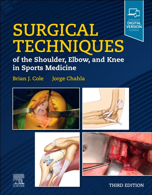 Surgical Techniques of the Shoulder, Elbow, and Knee in Sports Medicine, Hardback Book