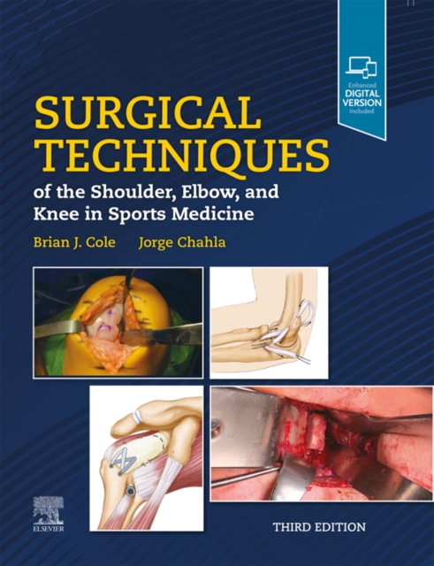 Surgical Techniques of the Shoulder, Elbow, and Knee in Sports Medicine, E-Book, EPUB eBook