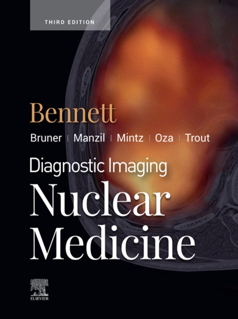 Diagnostic Imaging: Nuclear Medicine E-Book : Diagnostic Imaging: Nuclear Medicine E-Book, EPUB eBook