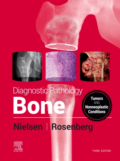 Diagnostic Pathology: Bone, EPUB eBook
