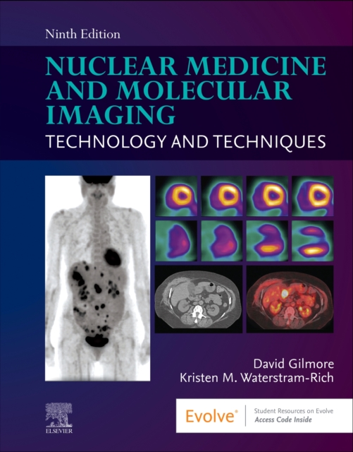 Nuclear Medicine and Molecular Imaging : Technology and Techniques, Paperback / softback Book