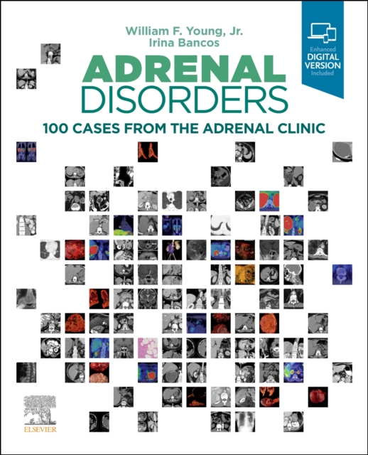 Adrenal Disorders : 100 Cases from the Adrenal Clinic, Hardback Book