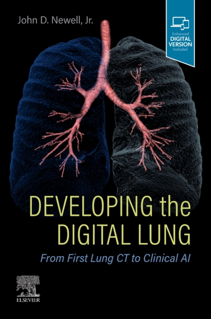 Developing the Digital Lung : From First Lung CT to Clinical AI, Paperback / softback Book