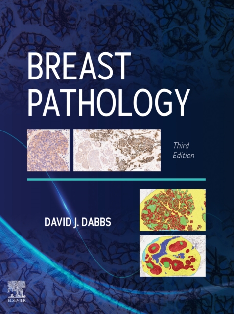 Breast Pathology, E-Book, EPUB eBook