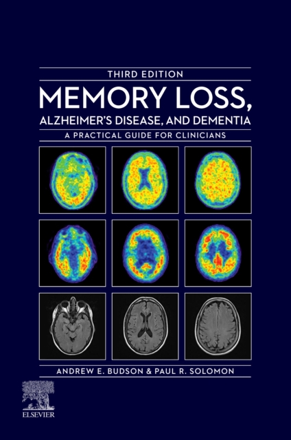 Memory Loss, Alzheimer's Disease, and Dementia - E-Book : A Practical Guide for Clinicians, EPUB eBook