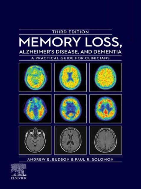 Memory Loss, Alzheimer's Disease, and Dementia - E-Book : A Practical Guide for Clinicians, EPUB eBook