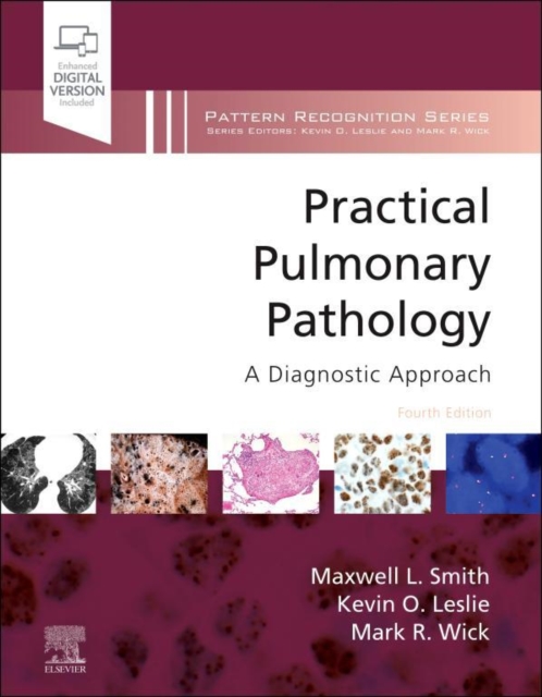 Practical Pulmonary Pathology: A Diagnostic Approach,E-Book : A Volume in the Pattern Recognition Series, EPUB eBook