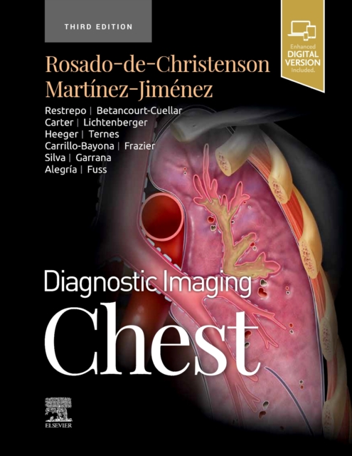 Diagnostic Imaging: Chest, Hardback Book