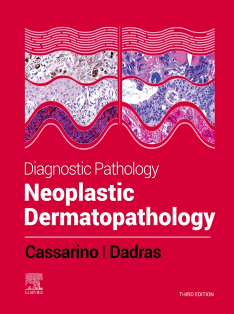Diagnostic Pathology: Neoplastic Dermatopathology E-Book : Diagnostic Pathology: Neoplastic Dermatopathology E-Book, EPUB eBook