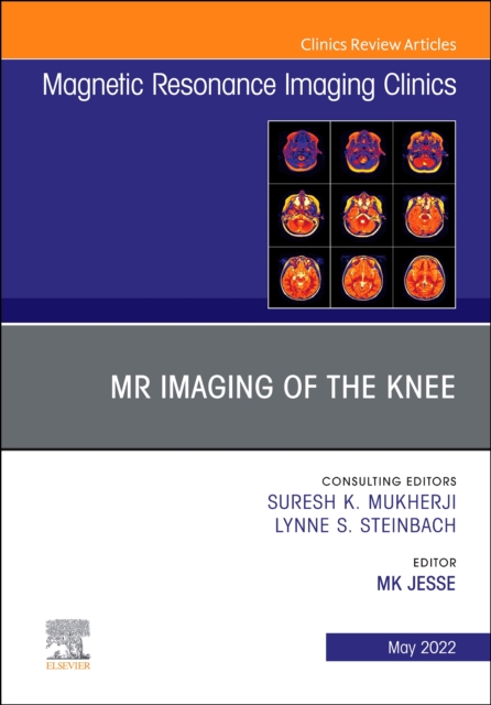 MR Imaging of The Knee, An Issue of Magnetic Resonance Imaging Clinics of North America : Volume 30-2, Hardback Book