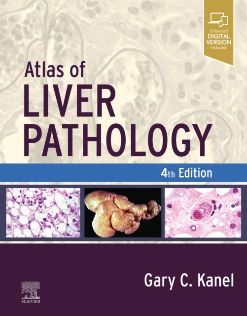 Atlas of Liver Pathology, EPUB eBook