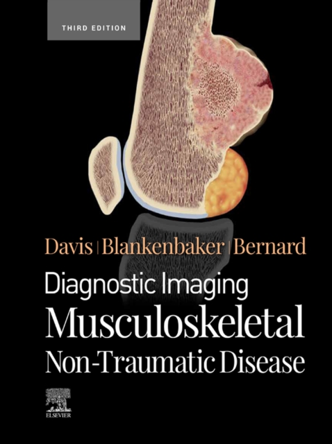 Diagnostic Imaging: Musculoskeletal Non-Traumatic Disease - E-Book : Diagnostic Imaging: Musculoskeletal Non-Traumatic Disease - E-Book, EPUB eBook