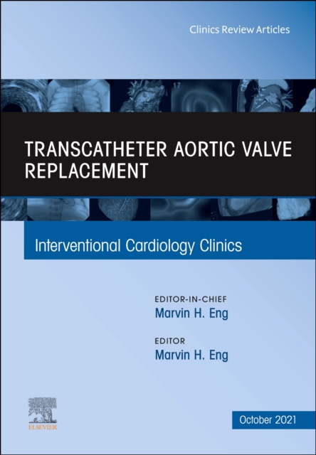 Transcatheter Aortic valve replacement, An Issue of Interventional Cardiology Clinics : Volume 10-4, Hardback Book