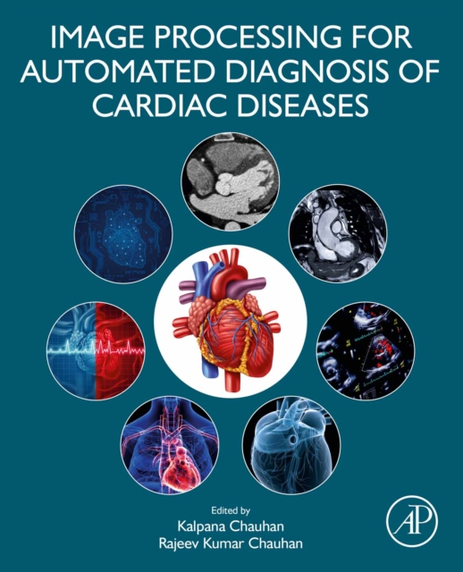Image Processing for Automated Diagnosis of Cardiac Diseases, EPUB eBook