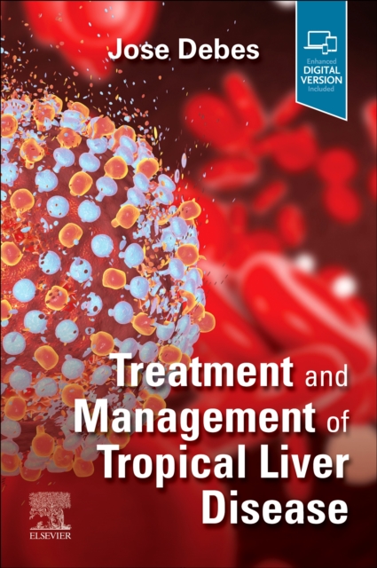 Treatment and Management of Tropical Liver Disease, Paperback / softback Book