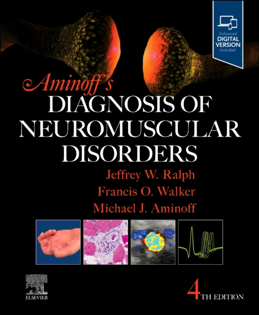 Aminoff's Diagnosis of Neuromuscular Disorders, Hardback Book