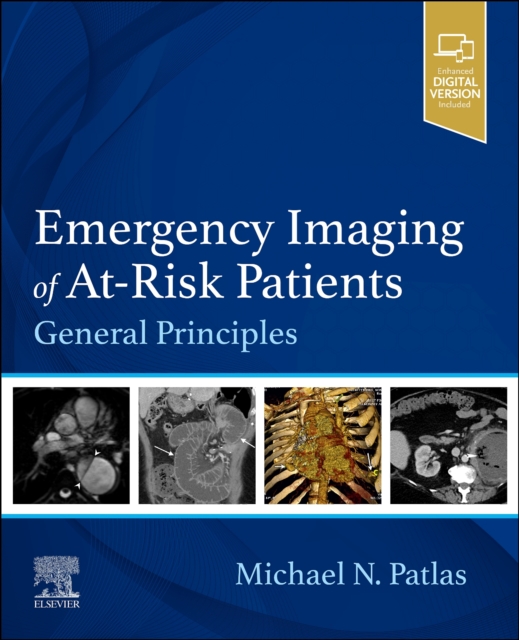 Emergency Imaging of At-Risk Patients : General Principles, Paperback / softback Book