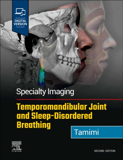 Specialty Imaging: Temporomandibular Joint and Sleep-Disordered Breathing, Hardback Book