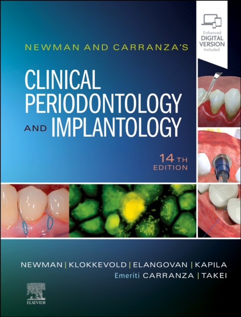 Newman and Carranza's Clinical Periodontology and Implantology, Hardback Book