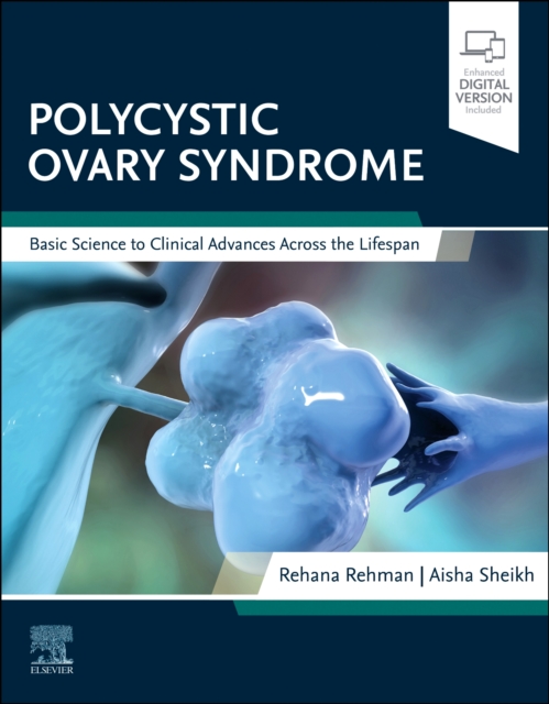 Polycystic Ovary Syndrome : Basic Science to Clinical Advances Across the Lifespan, Paperback / softback Book