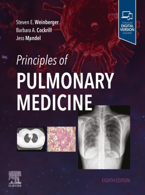 Principles of Pulmonary Medicine - E-Book, EPUB eBook