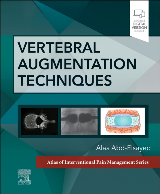 Vertebral Augmentation Techniques, Hardback Book