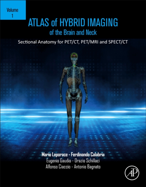 Atlas of Hybrid Imaging Sectional Anatomy for PET/CT, PET/MRI and SPECT/CT Vol. 1: Brain and Neck : Sectional Anatomy for PET/CT, PET/MRI and SPECT/CT, Paperback / softback Book